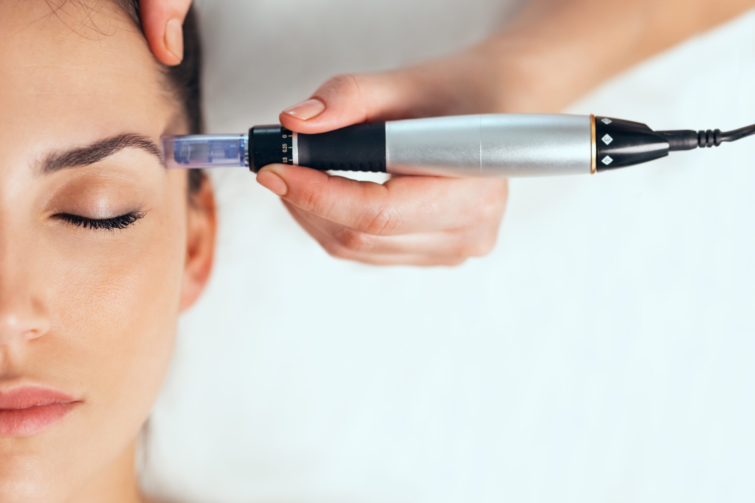 What Is Microneedling with PRP?